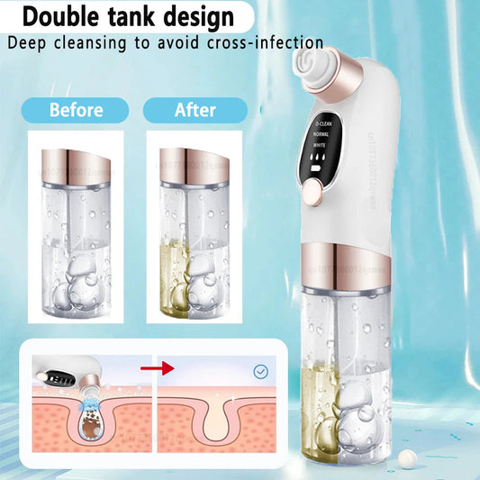 Blackhead Remover Pore Vacuum Face Nose Deep Cleaning Electric Pimple